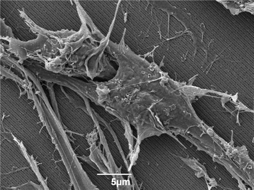 Scanning electronic microscope image of neurons cultured on a photonic crystal surface